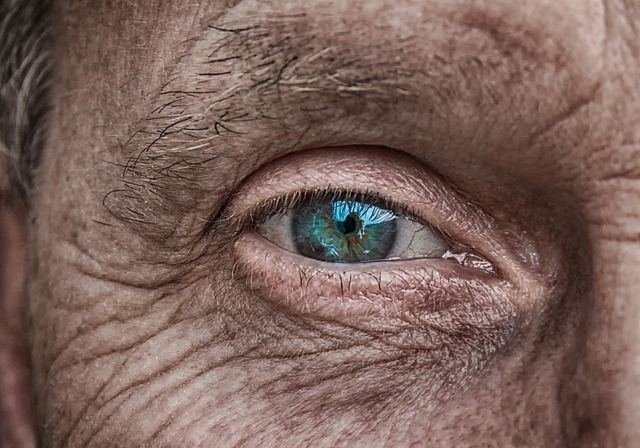 Eye Dilation
