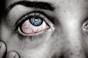 Optometrist